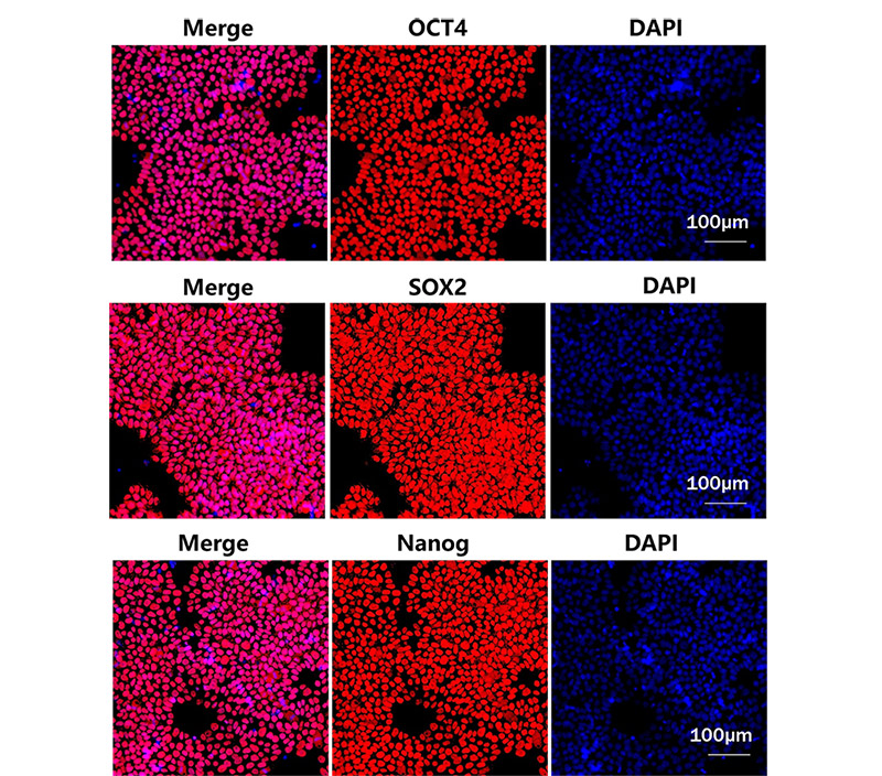 Utilizing GMP-Grade Laminin for Scalable Manufacturing of iPSC-Derived Cell Therapies