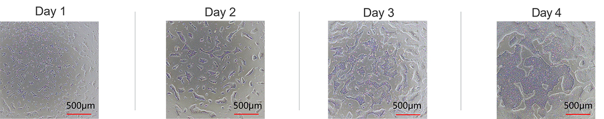 High Quality Laminin Protein supports Clinical iPSC Banking