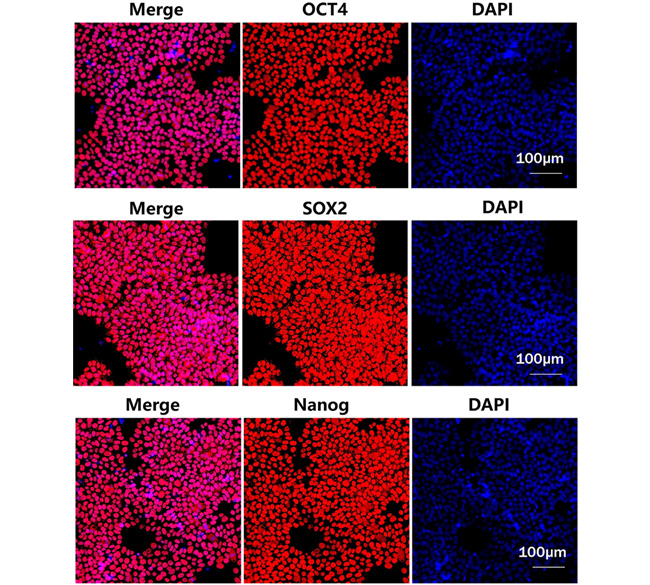 High Quality Laminin Protein supports Clinical iPSC Banking