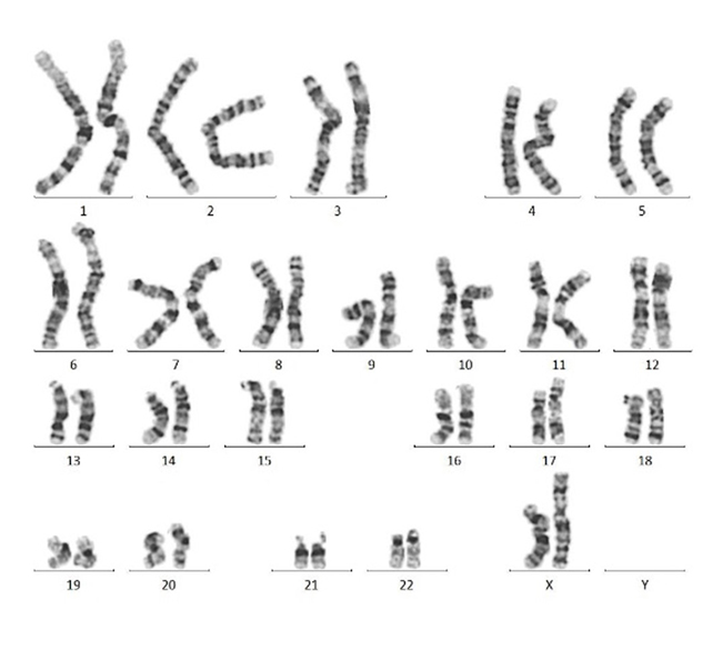 Extracellular Matrix (ECM) Proteins