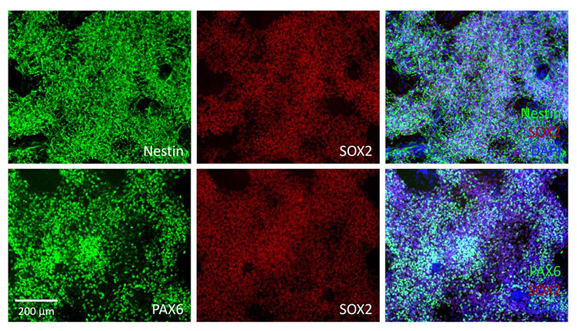 Immunofluorescence of Neural Progenitor Cells