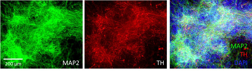 Neural Progenitor Cells Differentiate Into Dopamine Neurons