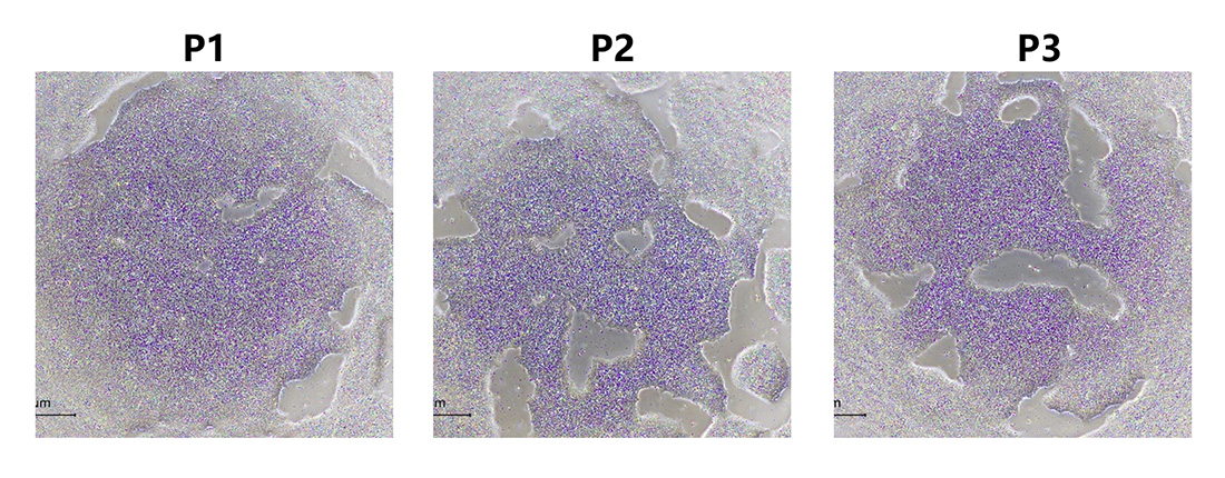 High Quality Laminin Protein supports Clinical iPSC Banking