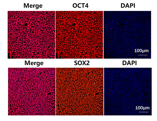 High Quality Laminin Protein supports Clinical iPSC Banking