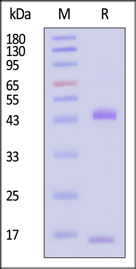 HLA-A*3303 & B2M SDS-PAGE