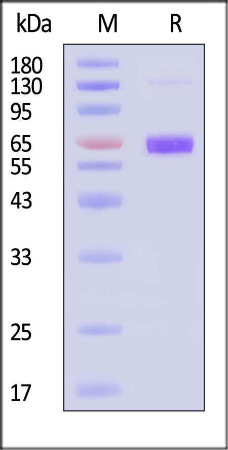 Neuraminidase (NA) SDS-PAGE