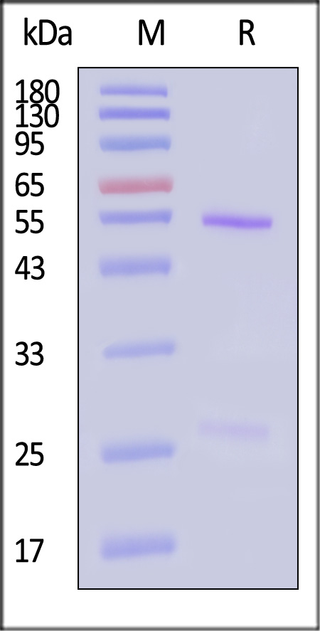 pre-Gc protein SDS-PAGE