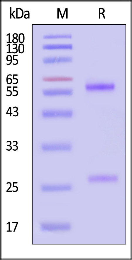 SN38 SDS-PAGE