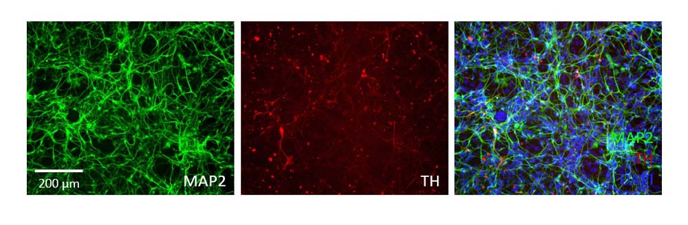  Organoids MARKER EXPRESSION