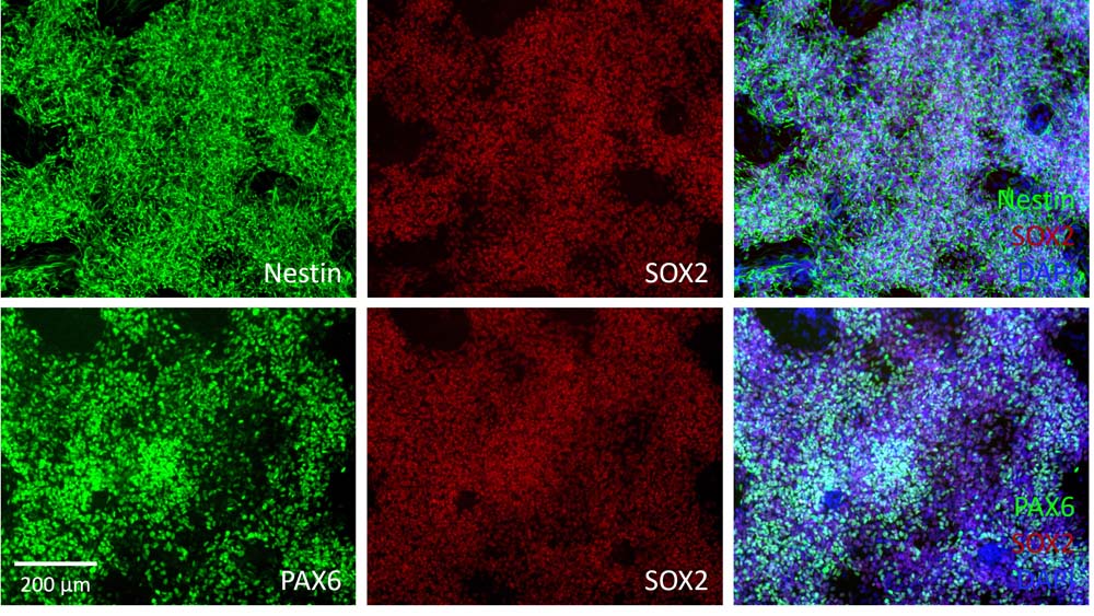  Organoids MARKER EXPRESSION