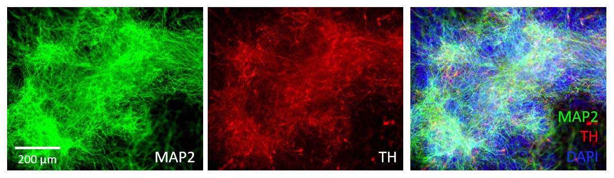  Organoids MARKER EXPRESSION