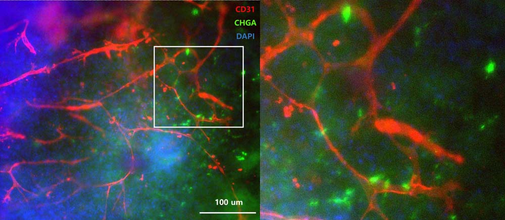  Organoids MARKER EXPRESSION