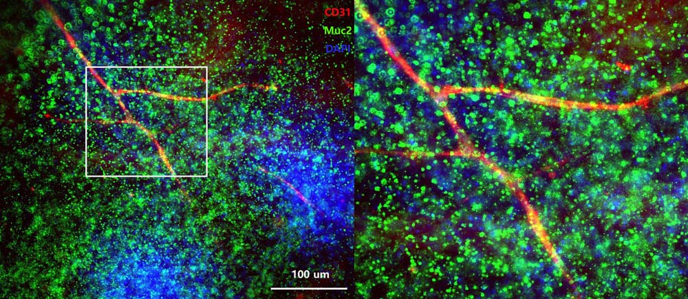  Organoids MARKER EXPRESSION